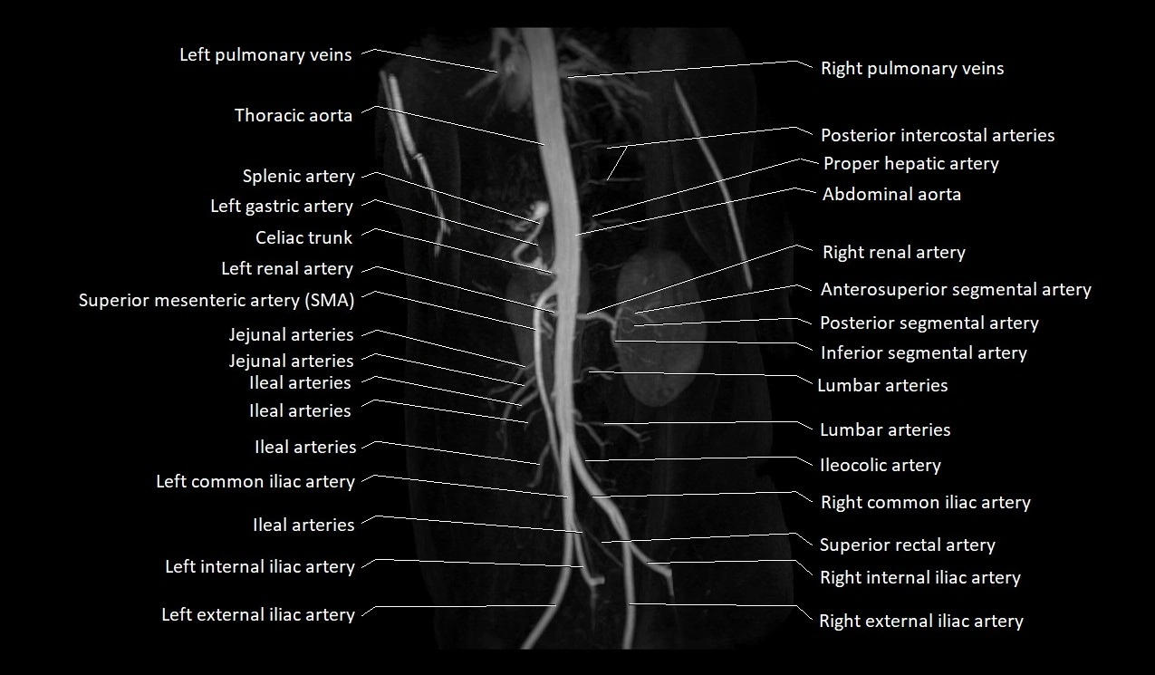 MRA abdomen (renal and mesenteric) angiography MIP 3D anatomy image 8.webp